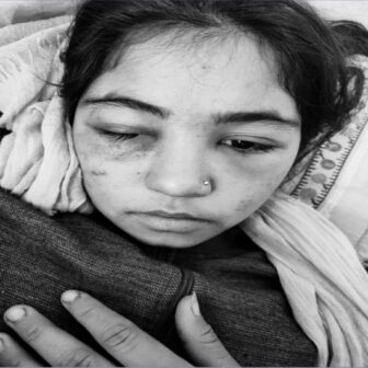 सौतेनी आमाको कुटपिटबाट बालिका गम्भीर घाइते, उपचारका लागि लगियो काठमाडौं