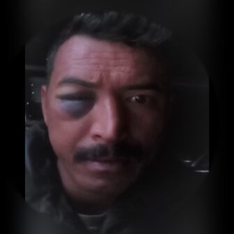 डोल्पाका इन्स्पेक्टरले कुटेर हवल्दारकाे आँखामा गम्भीर चोट