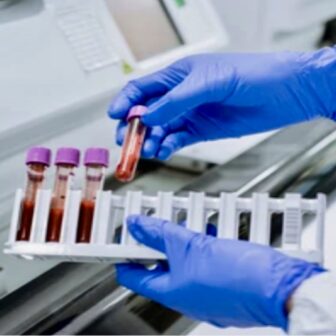 रगत परीक्षणबाट शरीरको विभिन्न अंगको आयु पत्ता लगाउन सकिन्छ: अध्ययन