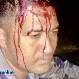 नेपाल-भारतको सिमा क्षेत्रमा तस्करद्वारा सशस्त्र प्रहरीका जवानमाथि ढुङ्गा प्रहार