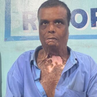 राजपुर इँटाभट्टा बम बिष्फोटको साक्षी गौरीशंकरको आँसु– “घरको ढोकामा बम पड्कियो, होस खुल्दा भारतको अस्पतालमा थिएँ”