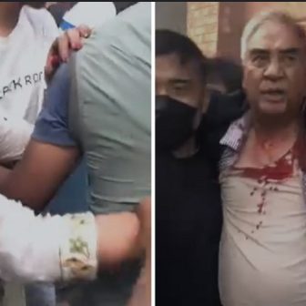 देउवाको स्वास्थ्यमा सुधार, टाउकोमा १२ टाँका